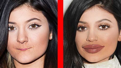 plastic surgery before and after.